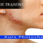 Retusz twarzy. Usuwanie trądziku - kurs photoshop