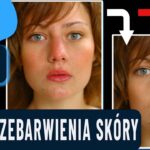 redukcja przebarwień skóry